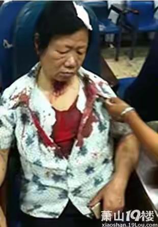 焦大妈今年六十出头，老伴早早离世，年轻时一人扛起养家重担，一天打两份工拉扯一双儿