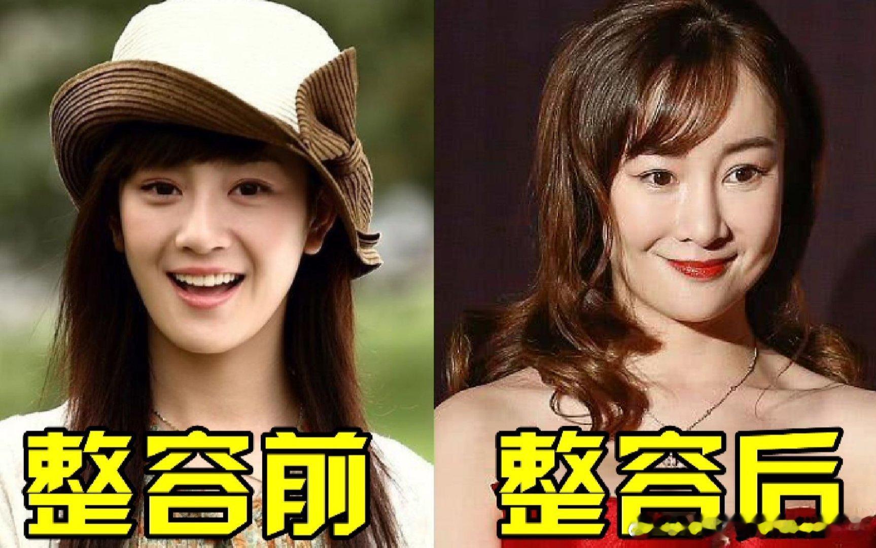 八字印为忌的人为什么不适合整容？因为印代表脸面，脸为忌再碰上印的大运流年就会造成