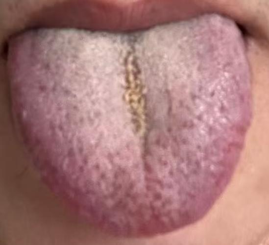 精关易失守，根源可能是阴虚火旺






有粉丝留言，早年耗损日久，虽说状态能