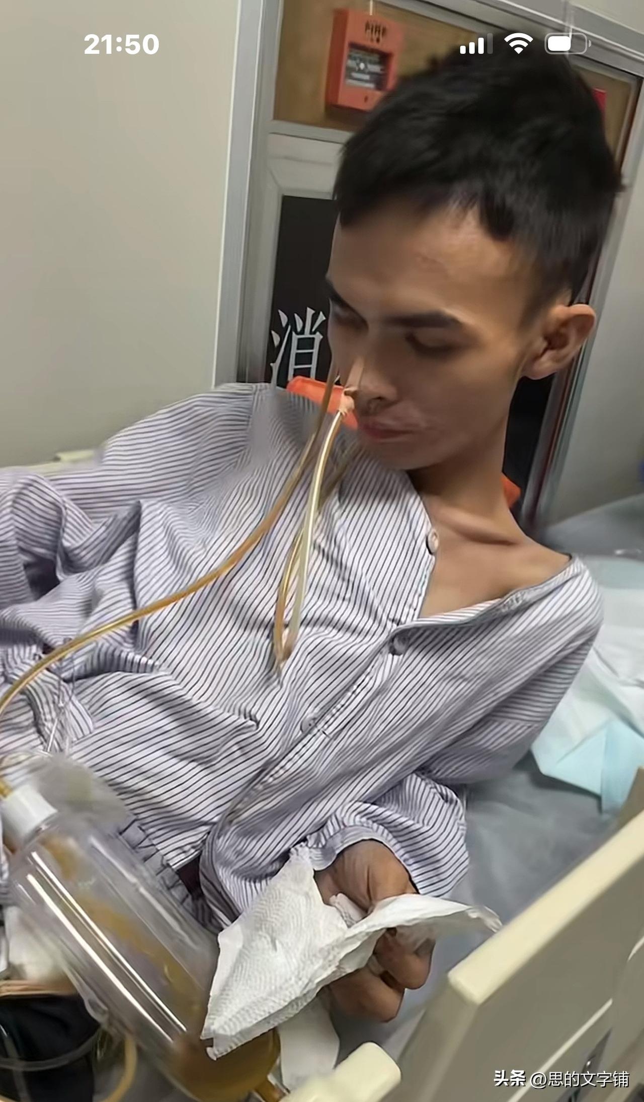 21岁男孩患肠癌晚期，瘦成一包骨头。
姐姐说：试验组也不让他进了。
网友评论：活