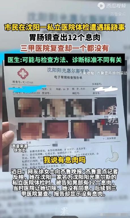 简直丧尽天良！8月22日辽宁沈阳，女子陪丈夫参加单位体检，顺手做了个胃肠镜。麻醉