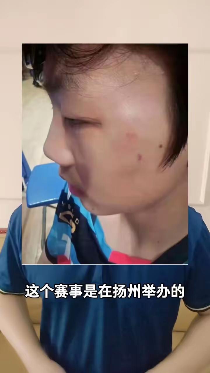 [玫瑰][小鼓掌][小鼓掌]扬州举办的国青国少江苏选拔赛，发生了一件令人唏嘘的事