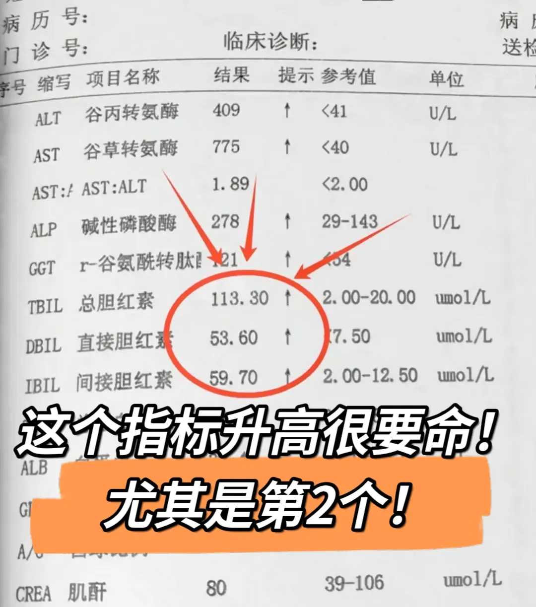 肝功能上这个指标升高要警惕！这个单子，转氨酶高达400多，总胆红素11...