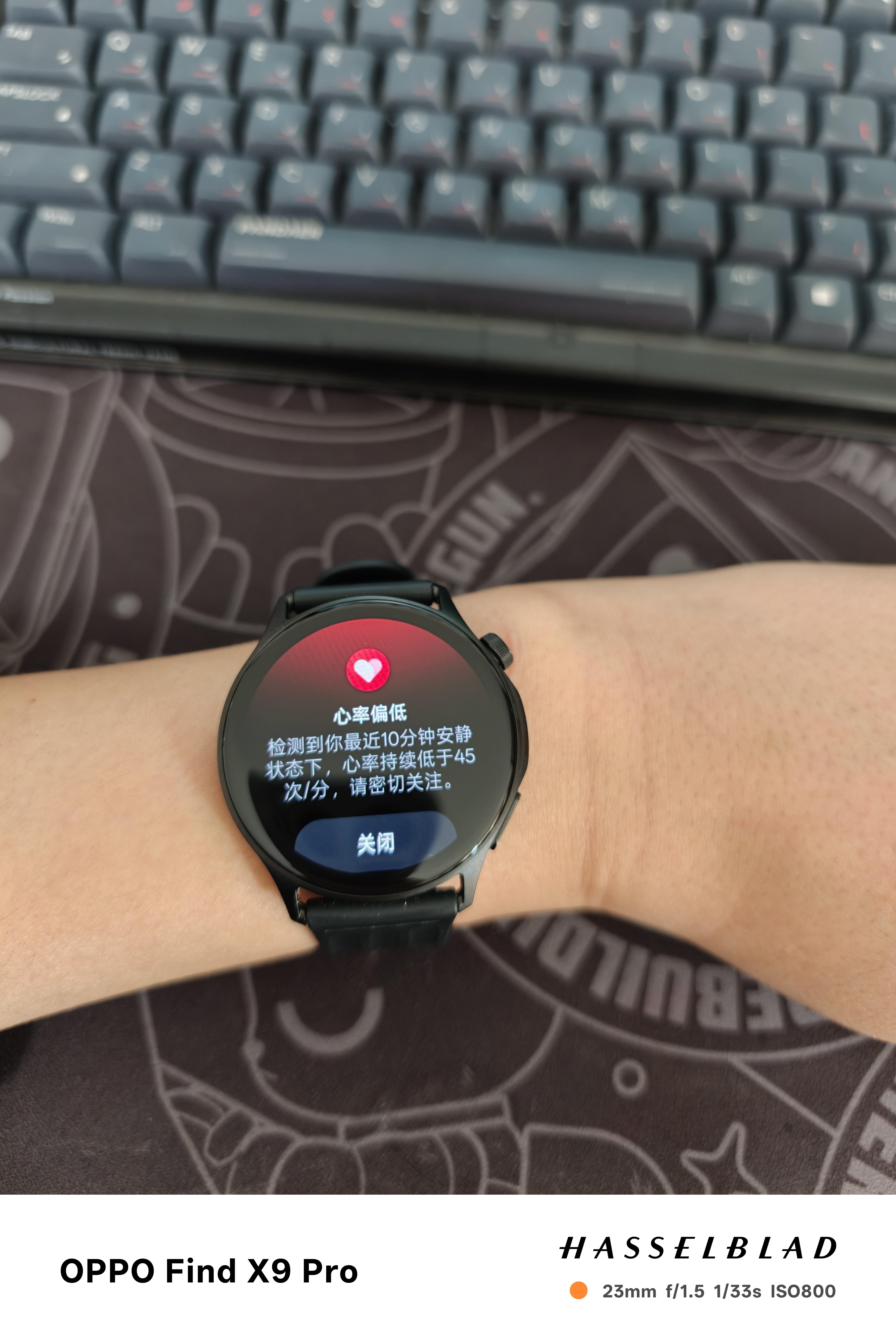 问一下这种情况是我异常概率大，还是手表心率检测异常概率大？