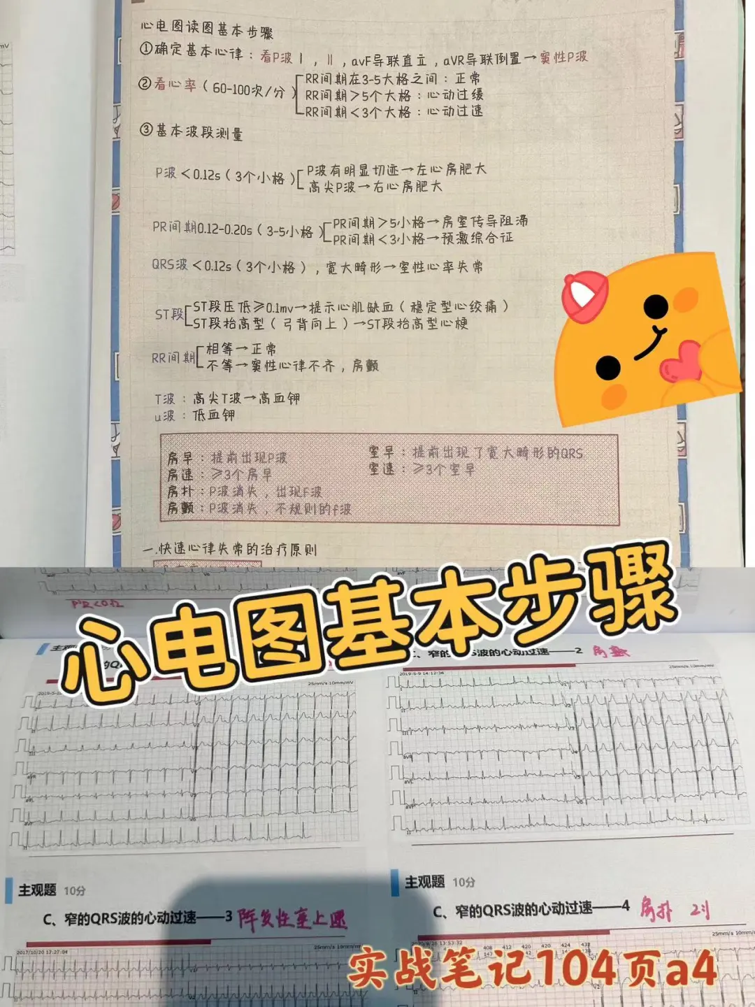 规培夜班心电图基本步骤实战