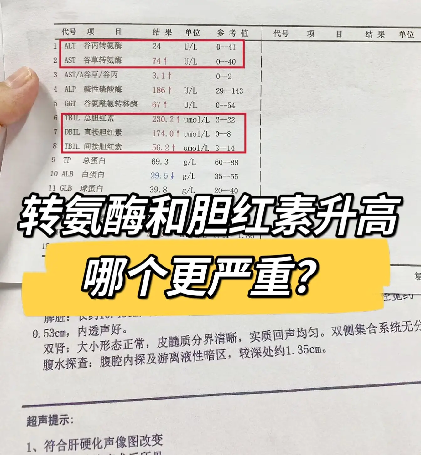 转氨酶升高和胆红素升高哪个更严重。转氨酶的正常值是0~40。如果超过正...