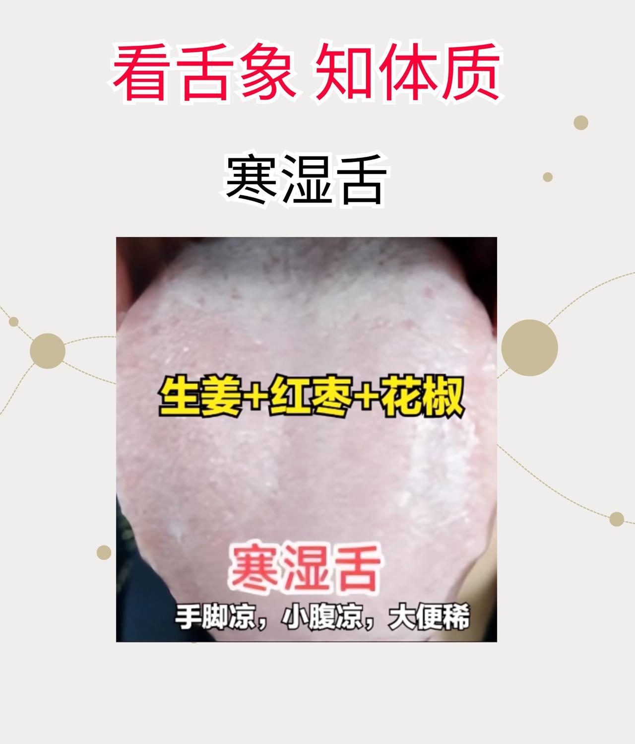 看舌象，知体质#科普##中医##养生#