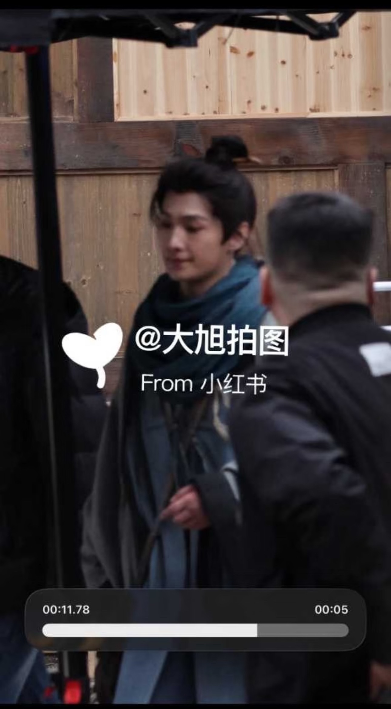 杨洋这手看着确实还是肿的 