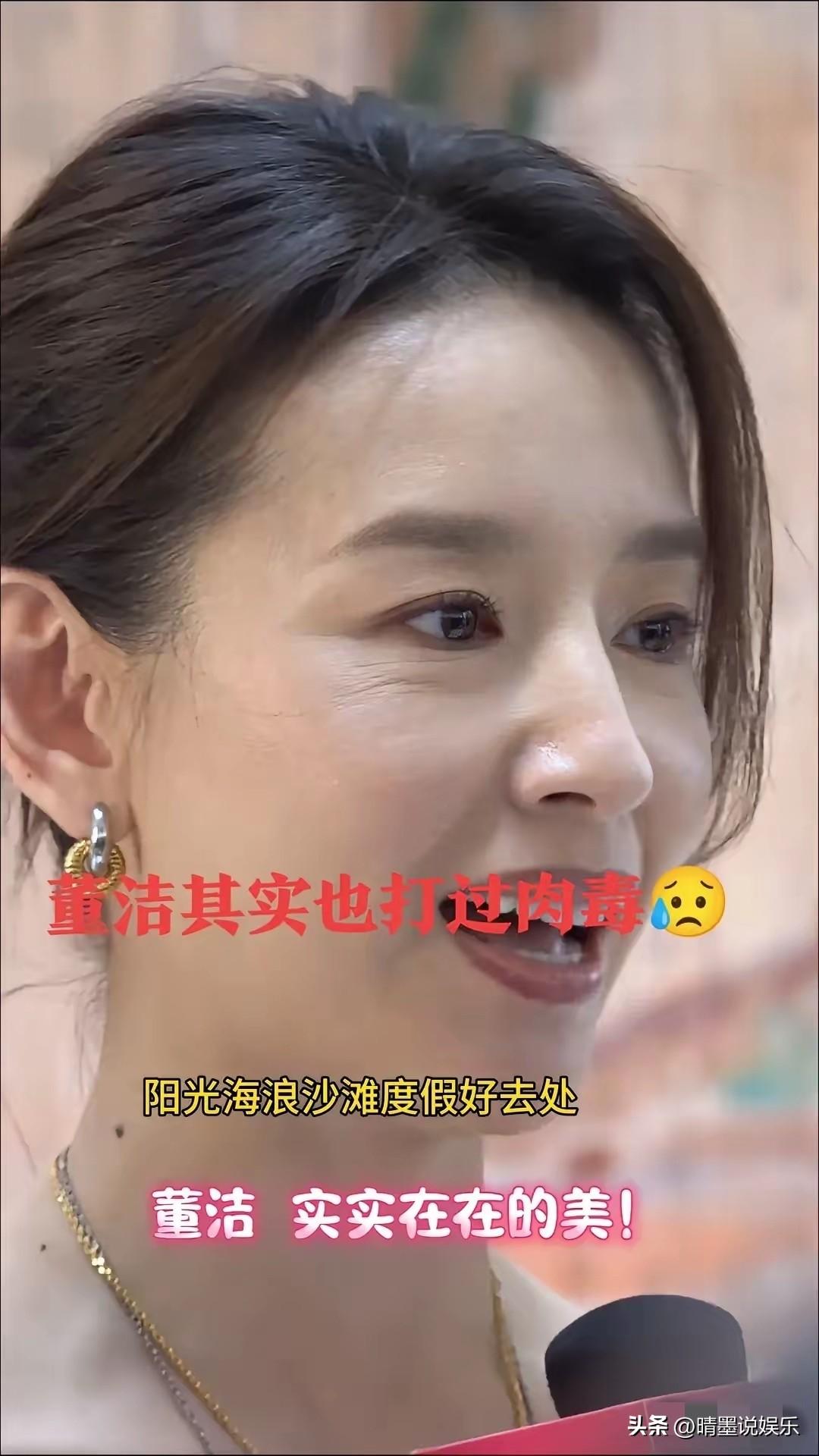 都说董洁是内娱典型的自然老去的女星，
但细看才发现，原来她也医美了。眼角打过肉毒