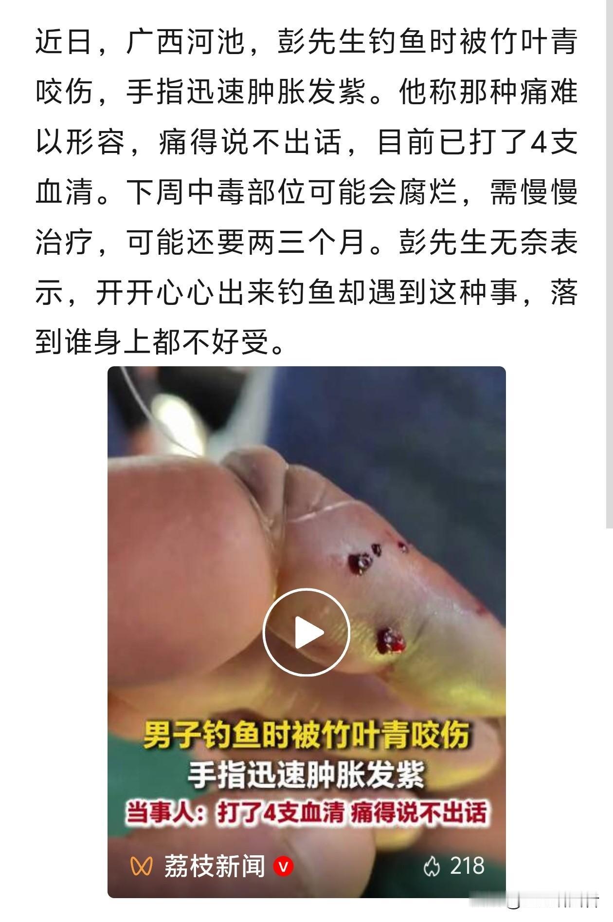 广西钓友野外钓鱼，惨遭竹叶青咬伤，手指瞬间肿成紫黑色
 
广西河池这件事，给所有