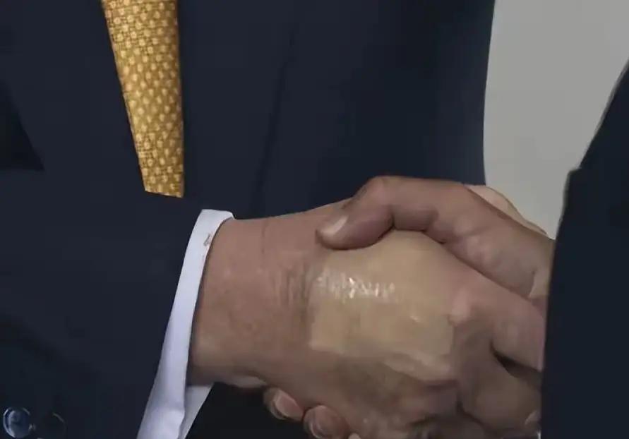 特朗普左手背上有大片瘀伤，已经被全球镜头定格。这不是偶然——过去一年，他的右手几