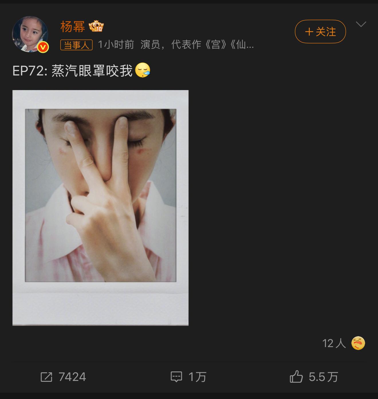 杨幂脸被蒸汽眼罩烫伤了事件迅速发酵，将蒸汽眼罩的温控技术推上风口浪尖。品牌方被呼