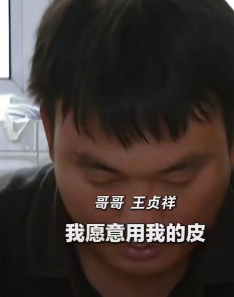 一场厨房突发爆炸，让一位操劳半生的母亲重度烧伤住进医院，而她的两个儿子，用最朴素