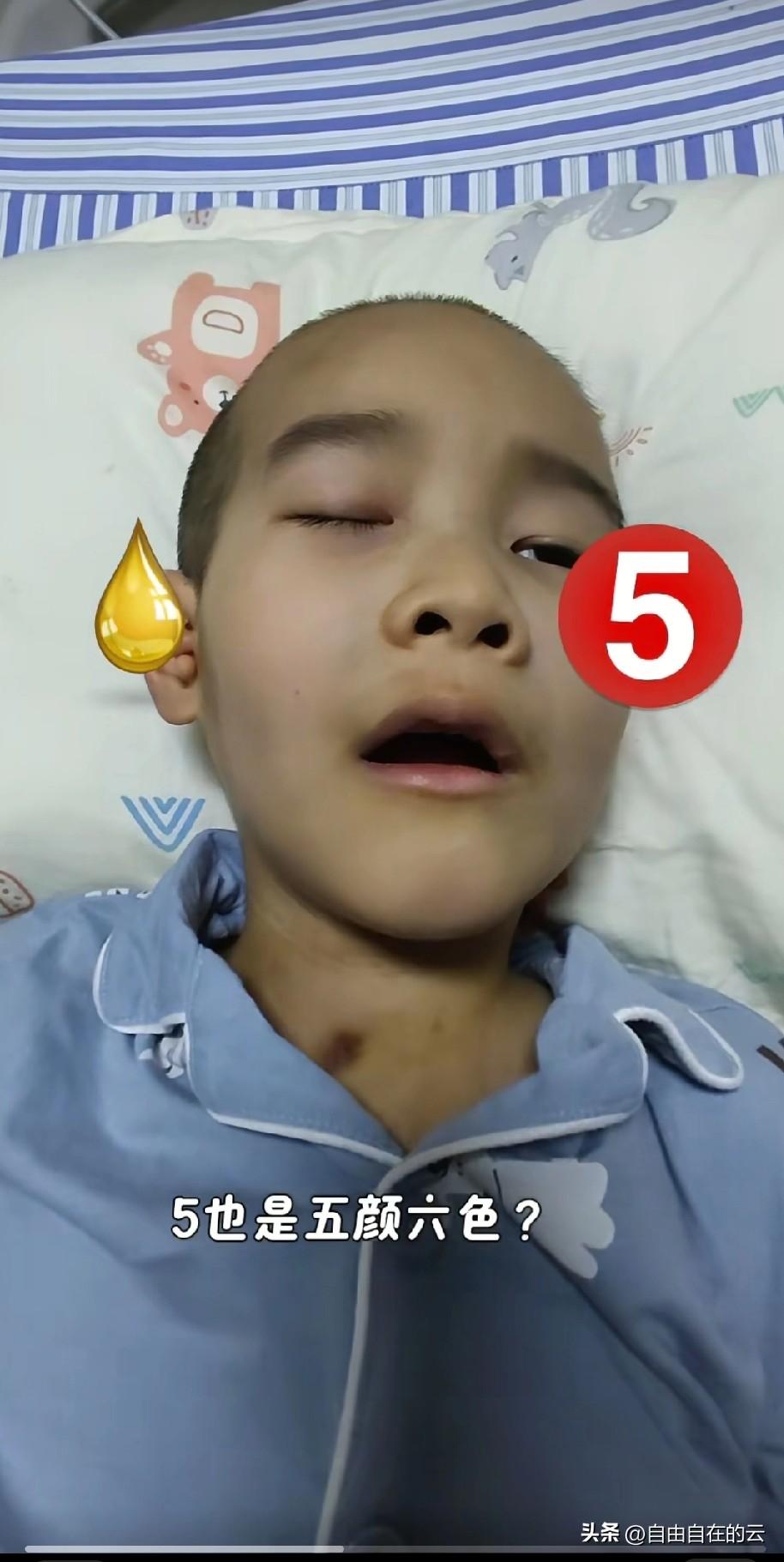 楚熙小朋友的妈妈求助广大网友，她说楚熙的神志是清醒的，但是因为眼部神经受伤，两个