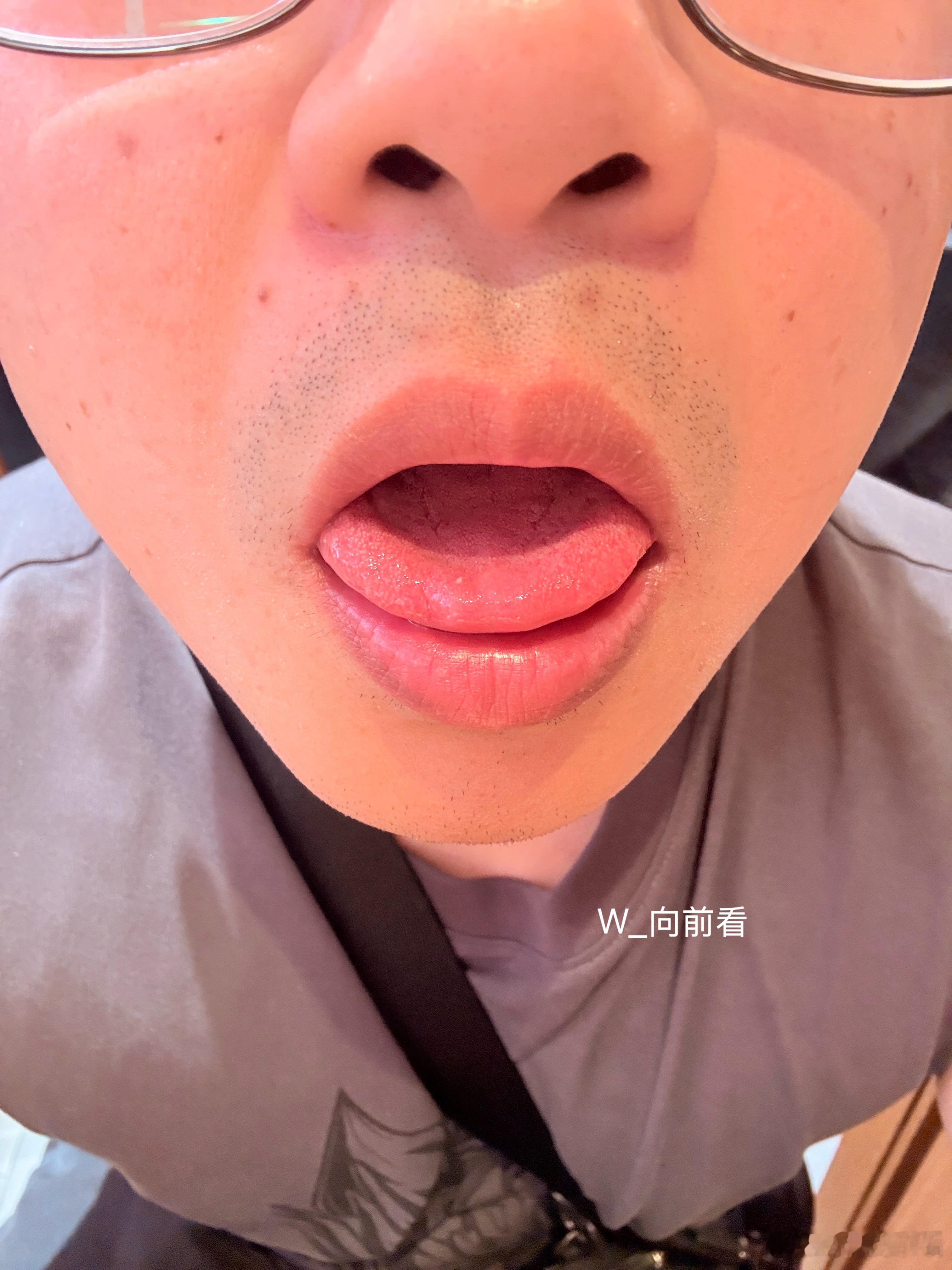 加了很多的花椒粉，现在吃完嘴全麻了！