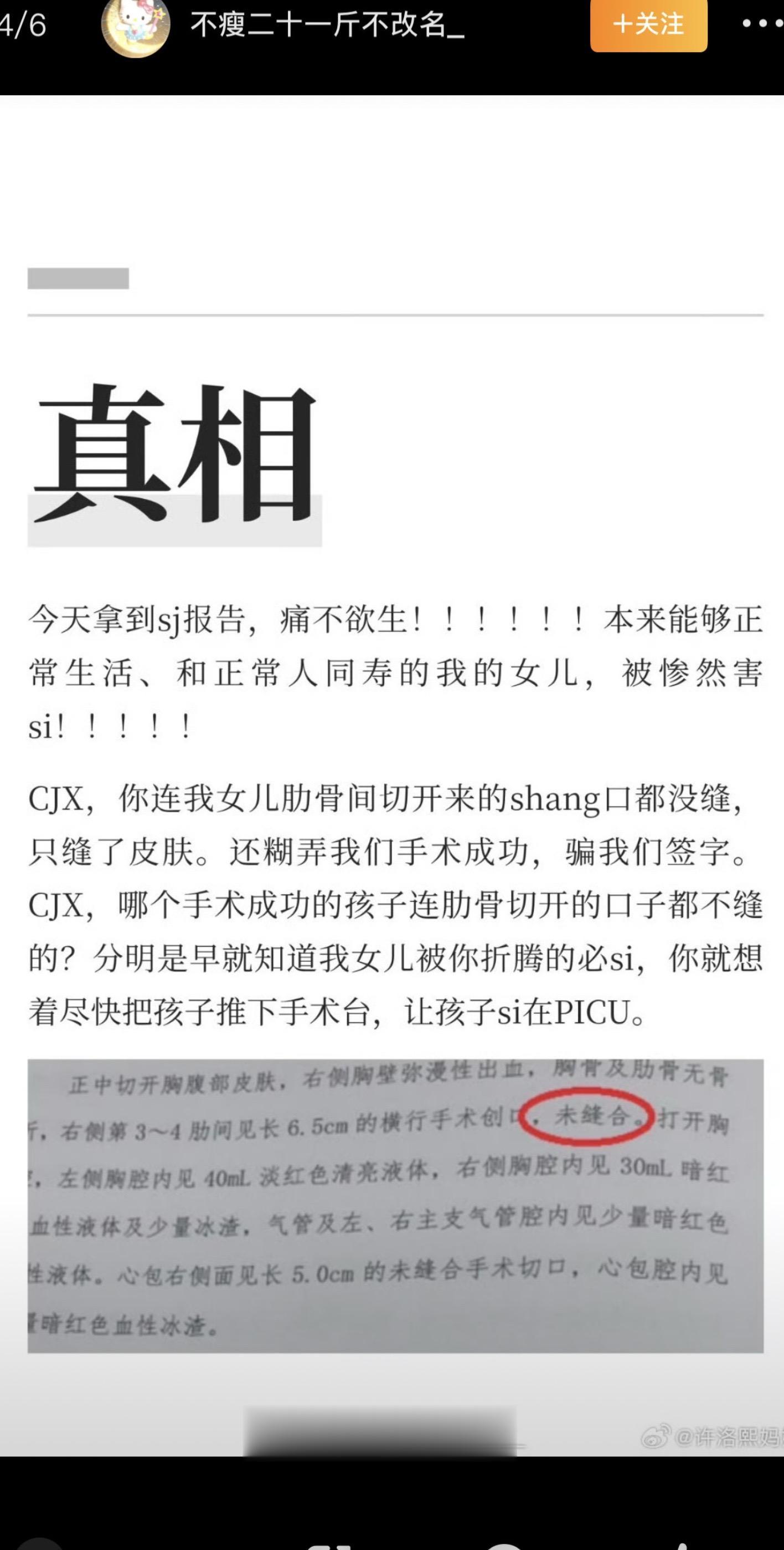 小洛熙 小洛熙事件