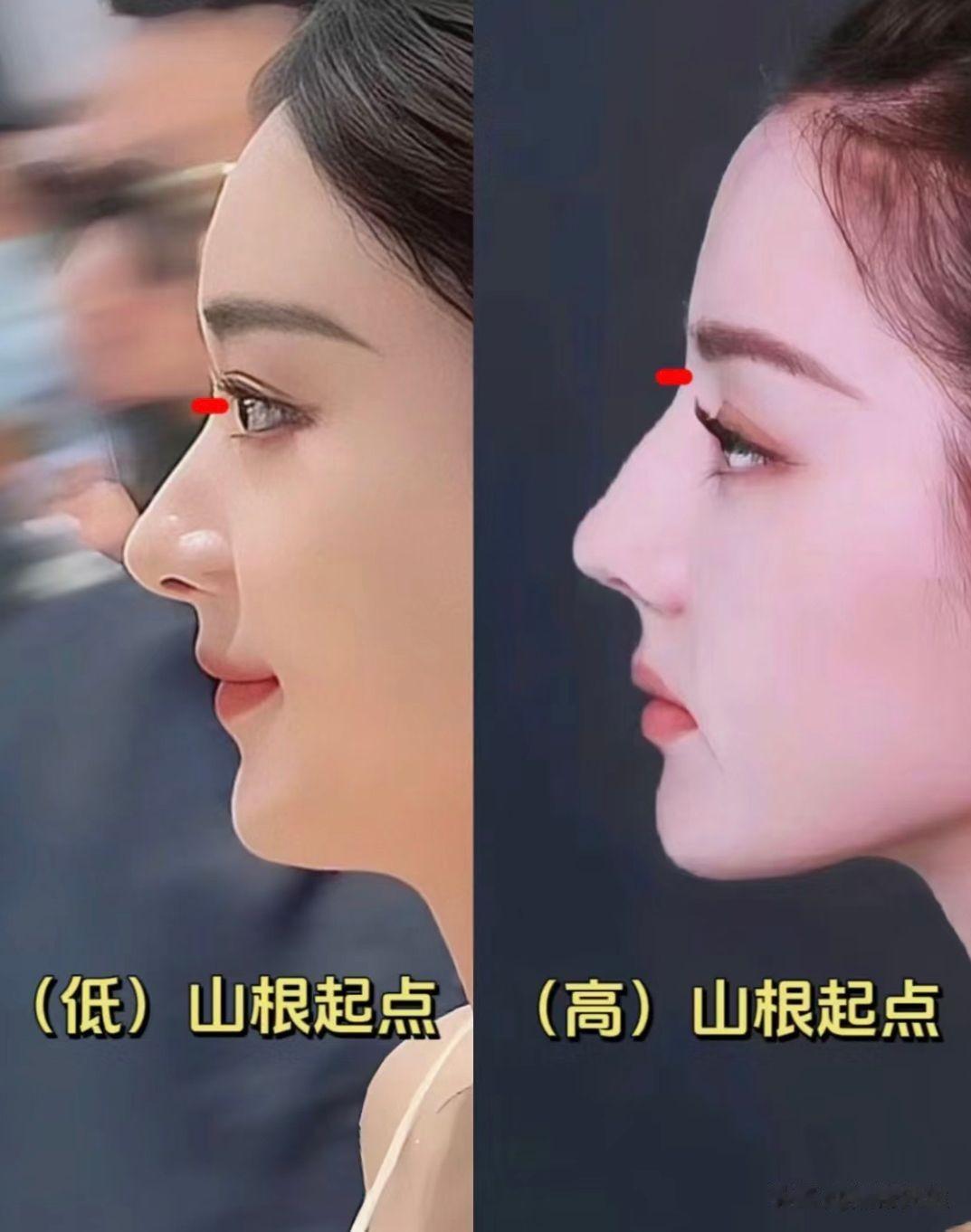 高鼻梁已经失宠了！现在的“低山根”反而更吃香，减龄又有氛围感
亚洲女性的底山根并