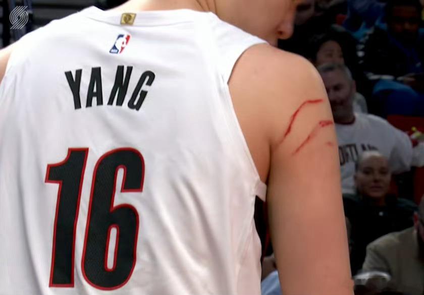 好家伙儿，亚当斯九阴白骨爪是不？给我们小杨抓成这样了？