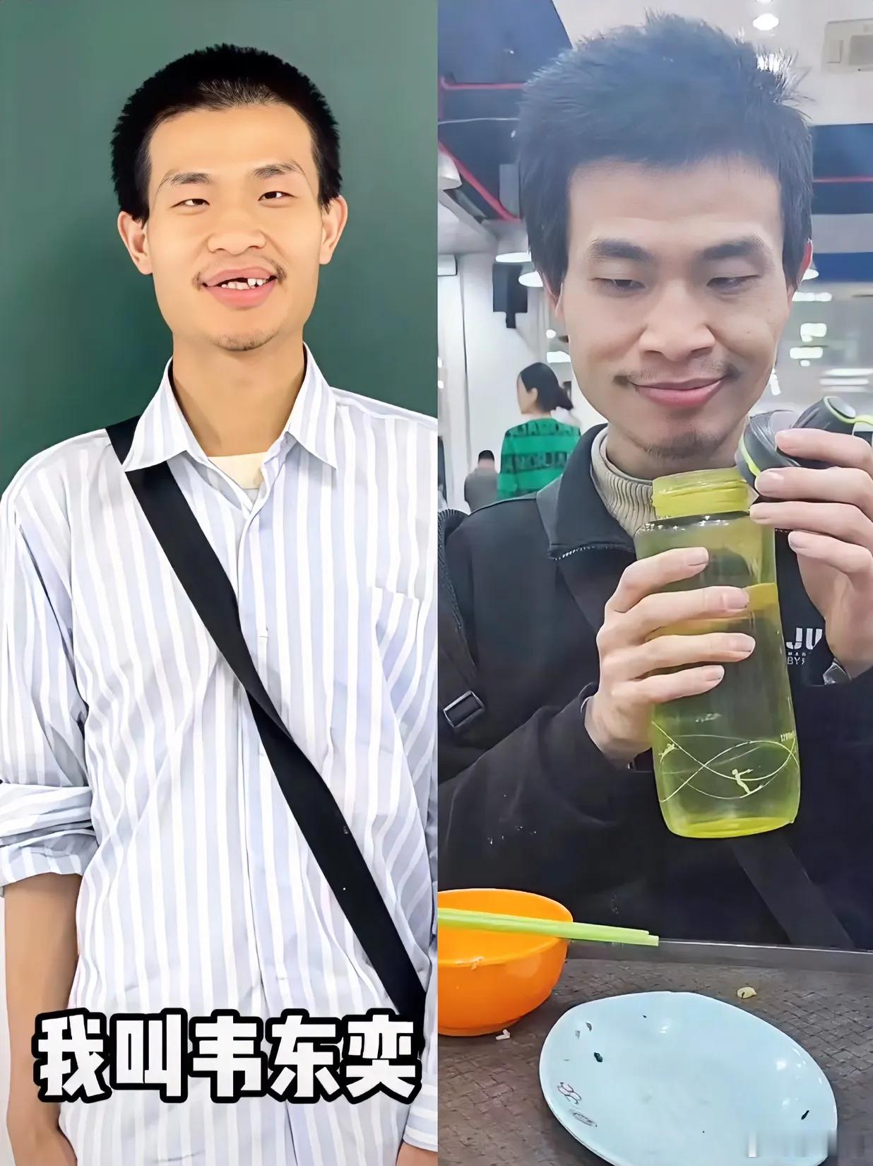 韦神患有牙周炎已在治疗韦神现在才30多岁，30多牙齿就脱落了这也太早了吧。​​听
