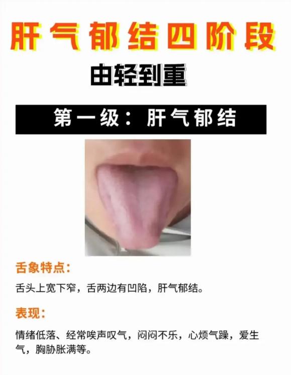 肝气郁结由轻到重，4 个阶段要分清