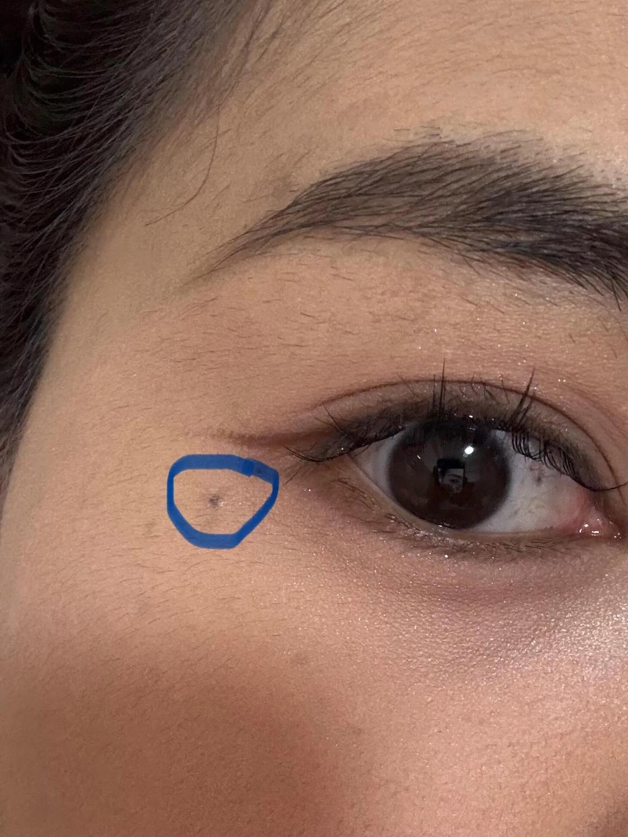 左眼眼下的痣要不要点掉
纠结要不要国庆去把这个痣点了，我妈一直觉得这个痣不好，让