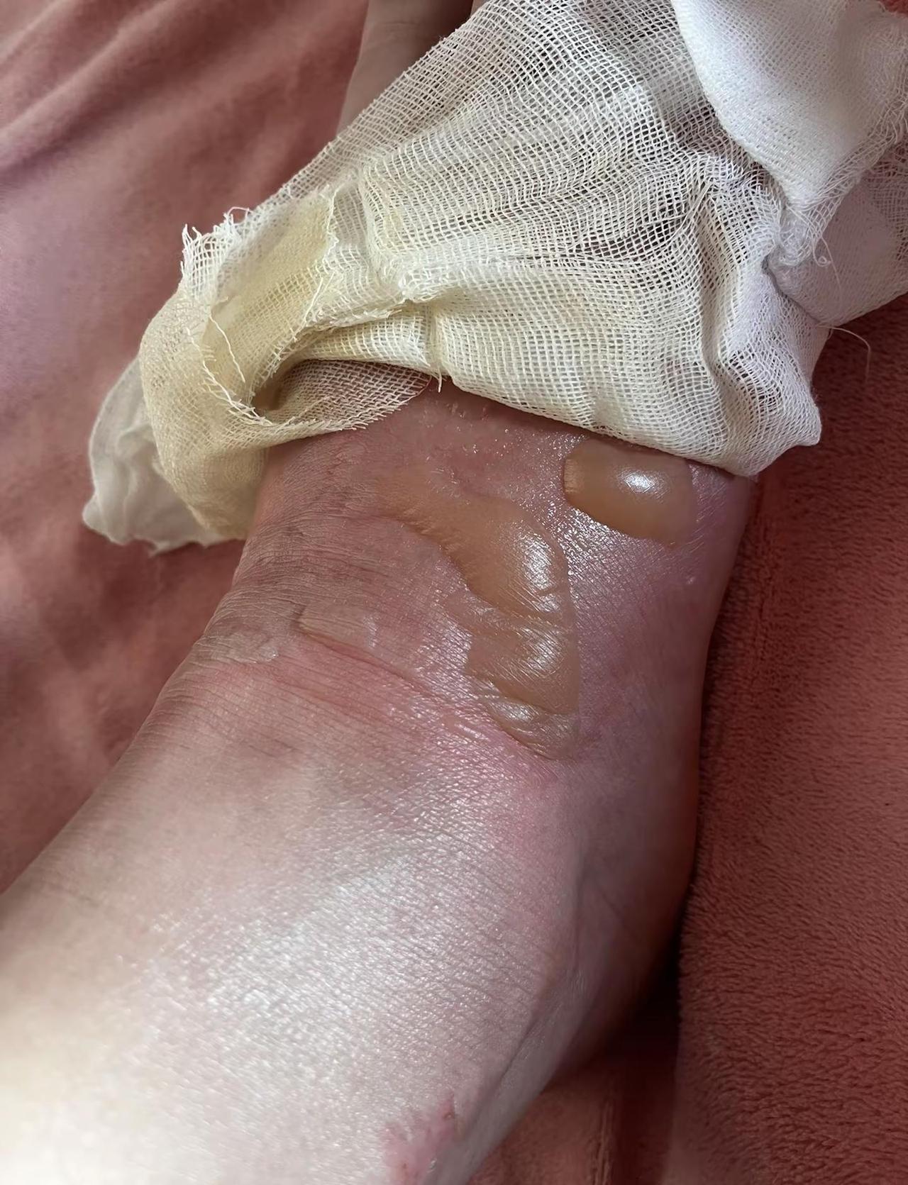 伤员一个@遇到事情不要慌 谁知道这是什么