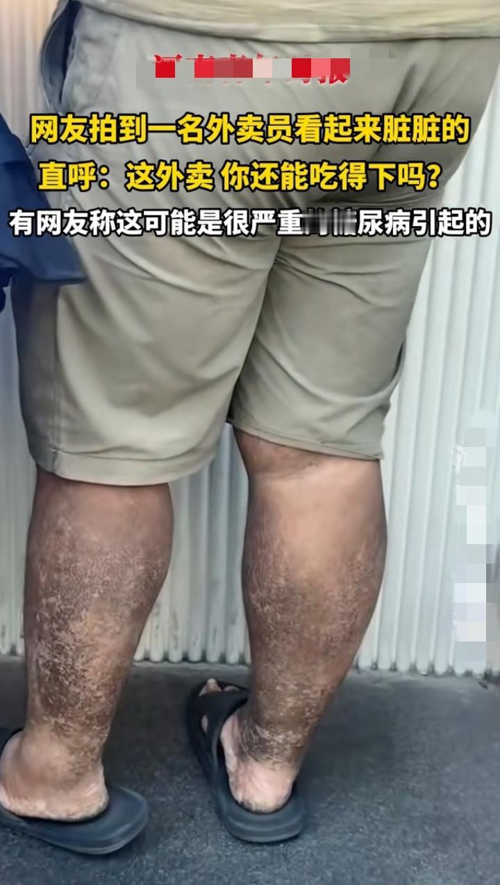 近日江西南昌，一网友下午3点在奶茶店门口买奶茶，无意中发现一个外卖小哥，全身脏兮