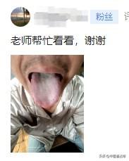 评论区舌诊实战分享
这个舌头拍的还是比较清晰的，我们一起来看一下
舌体：前段胖大
