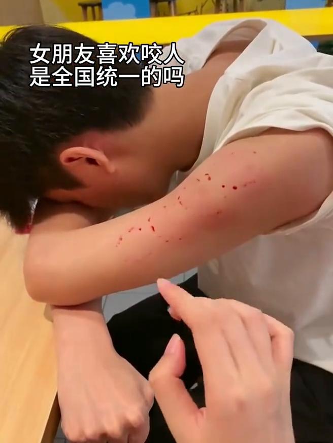 女朋友喜欢咬人，是全国统一的吗？