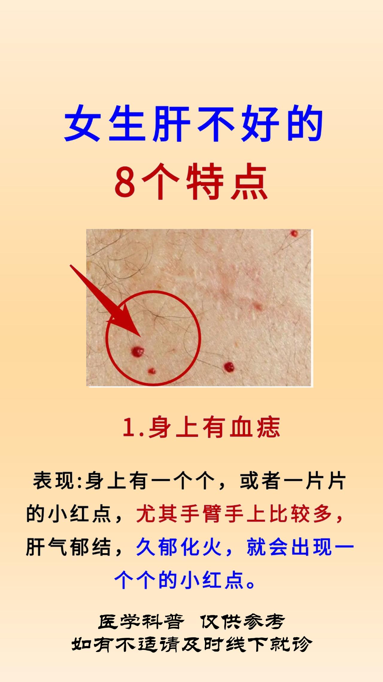 女生肝不好的8个特点，看看你占了几个。1个不占，说明肝很好#中医##养生##肝#
