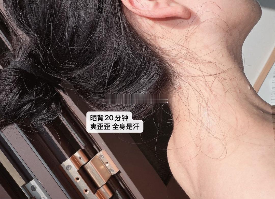 三伏天早上八九点钟的太阳就这样晒10～20分钟下午三四点再来袋儿祛湿饮排湿气的法