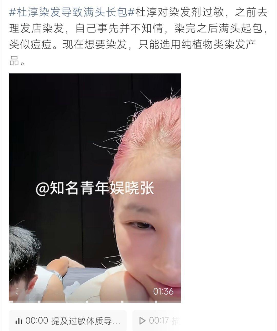 杜淳染发导致满头长包杜淳对染发剂过敏满头长包，无奈更换植物染发，过敏体质染发需谨