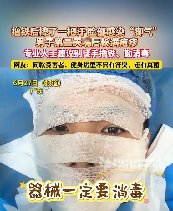 健身房的哑铃比马桶还脏？广东男子撸铁后随手擦把汗，第二天脸上长满“脚气”！网友：