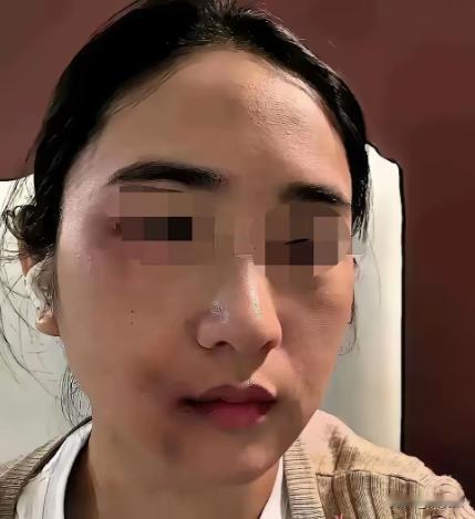 丈夫家暴妻子近十年，刚动手打完妻子三天，自己就确诊肝癌晚期，家人逼迫女方拿出全部