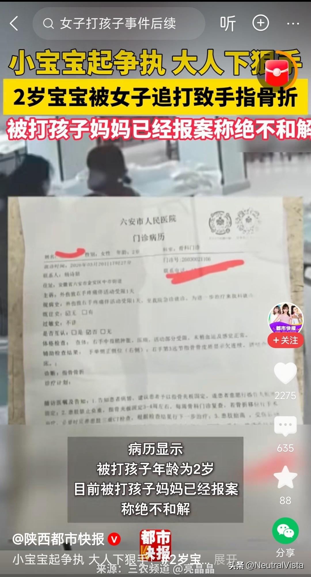 这女人疯了！连续多次暴打一个两岁宝宝，导致手指骨折。

安徽六安因为两个年龄相仿