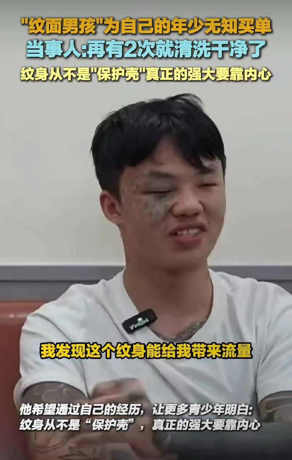 纹面男孩称再洗2次纹身就干净了如今他忍着激光洗纹的灼痛改错，还主动用经历提醒其他