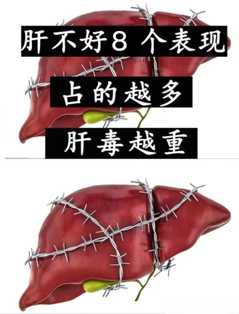 肝毒多的8大表现，最后1个，很多人都会有 1、痘痘反反复复。肝火大，身体毒素积累