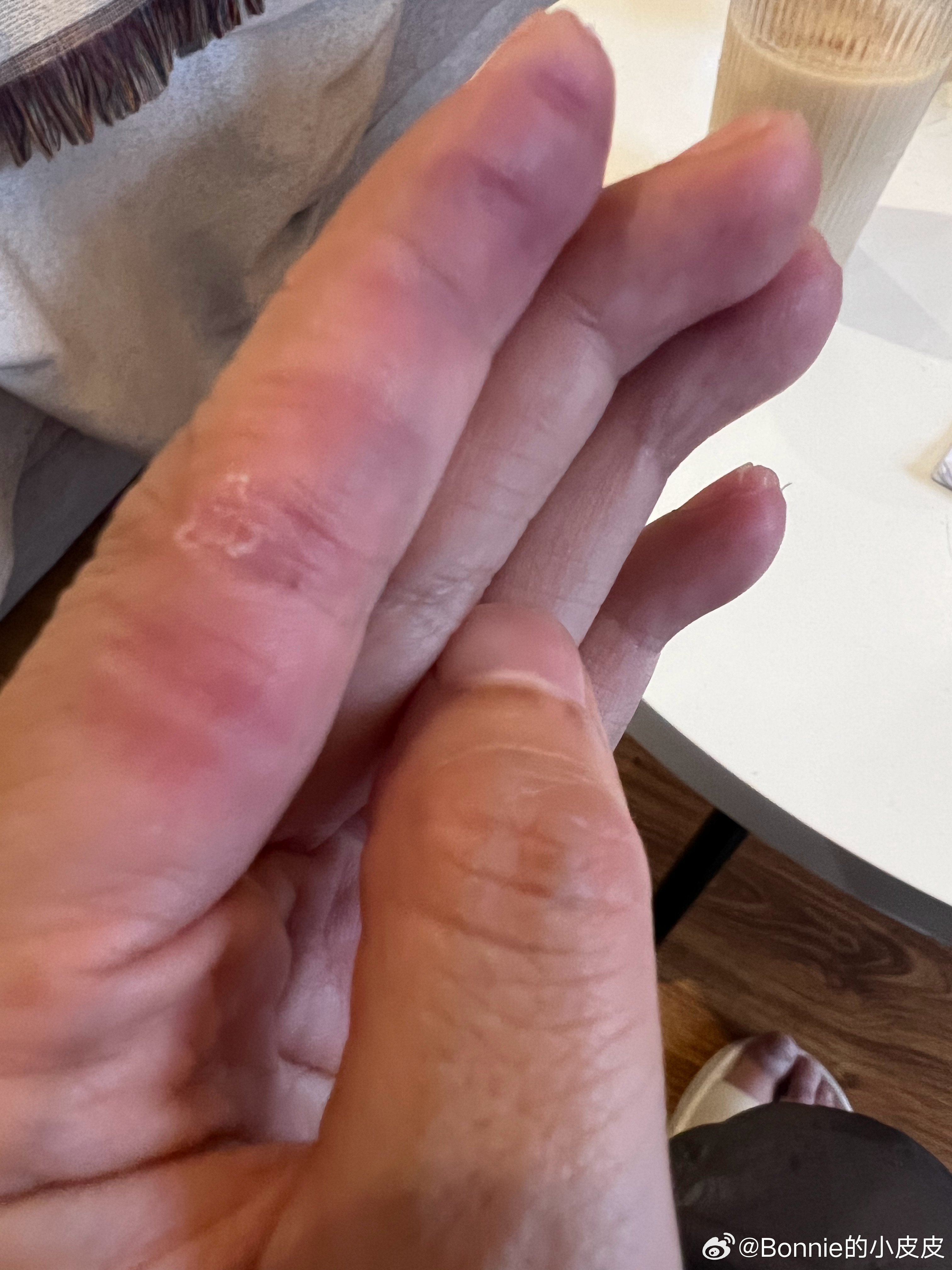 陈绮贞我跟你拼了 ​​​