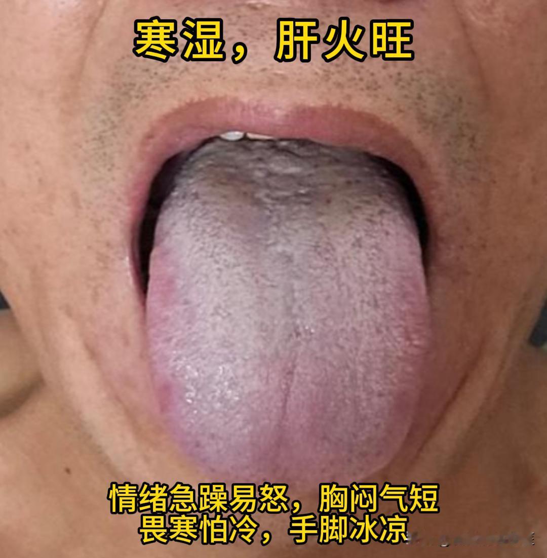 这会有时间，可以帮大家看看舌象。

有需要的，尽管把你的舌象照片发过来吧！越早发