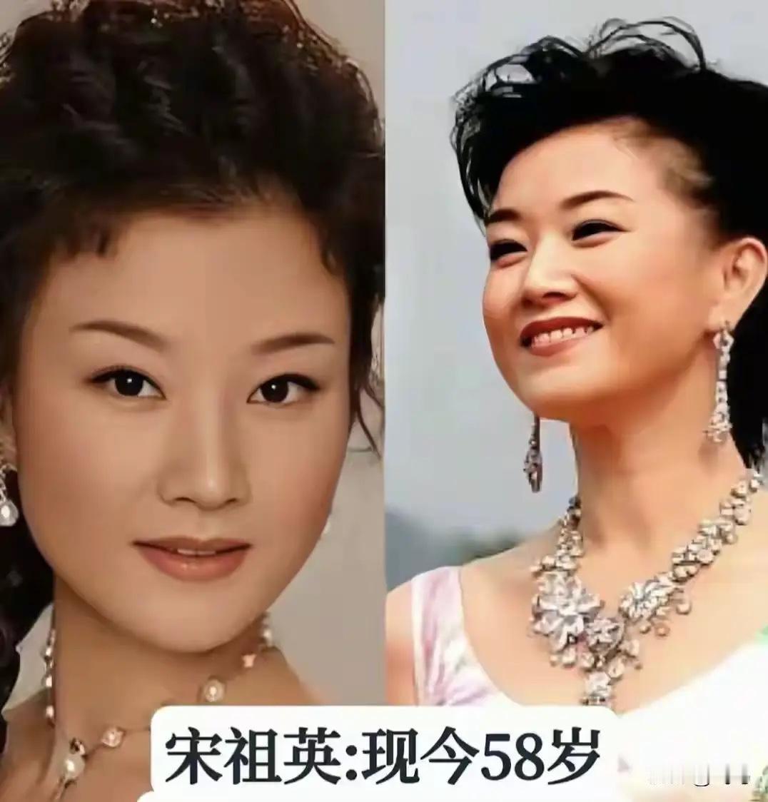 这些陪伴几代人青春的女高音，年轻时风华绝代，歌声响彻各大舞台。
毛阿敏一开口就是