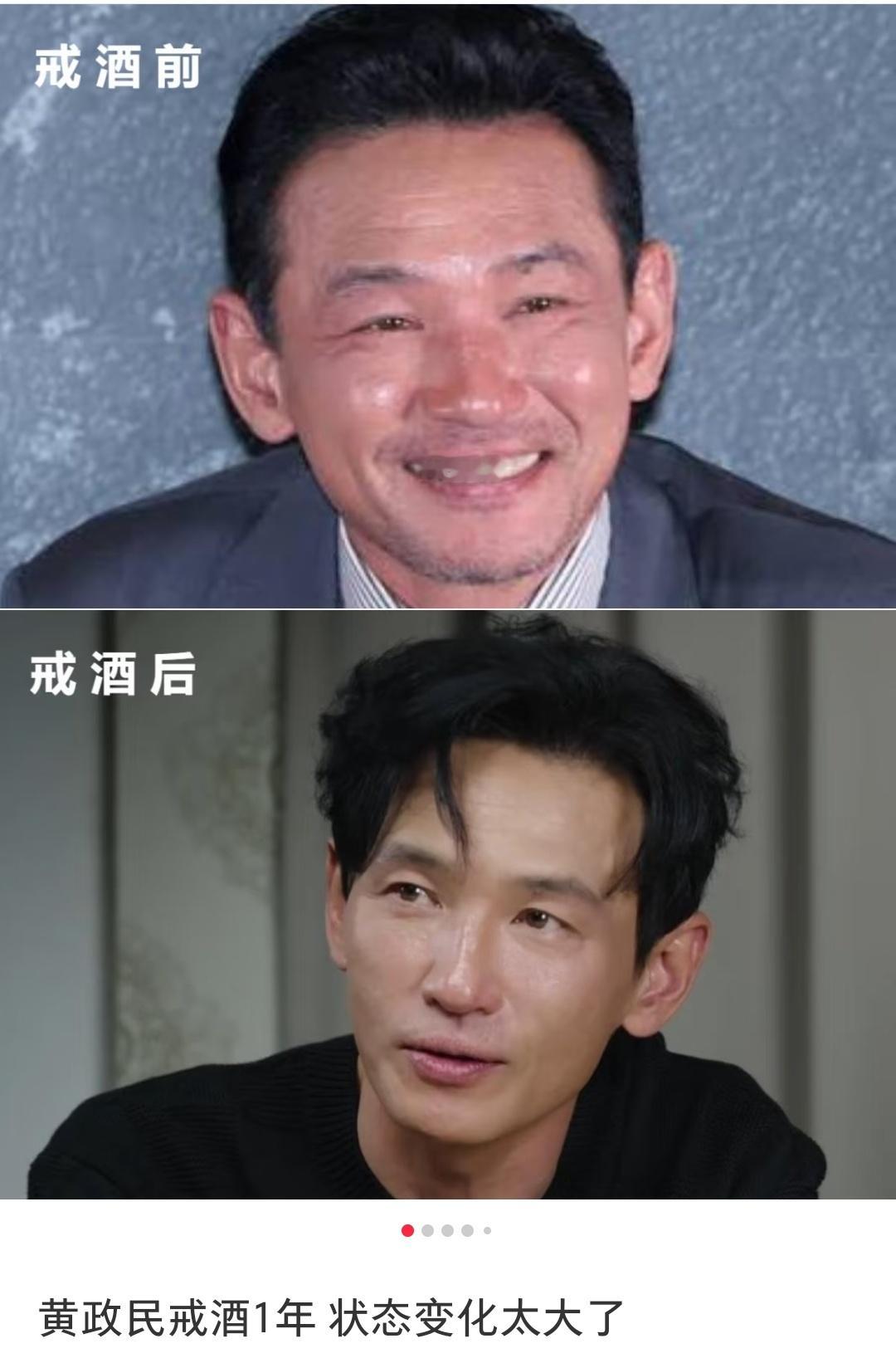 酒精影响好大啊，戒酒之后年轻这么多吗 