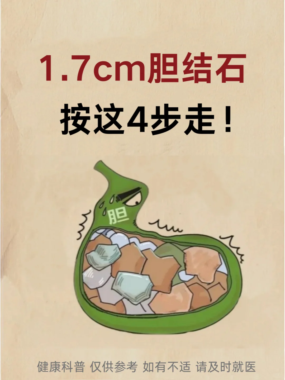 1.7cm胆结石，按这4步走！