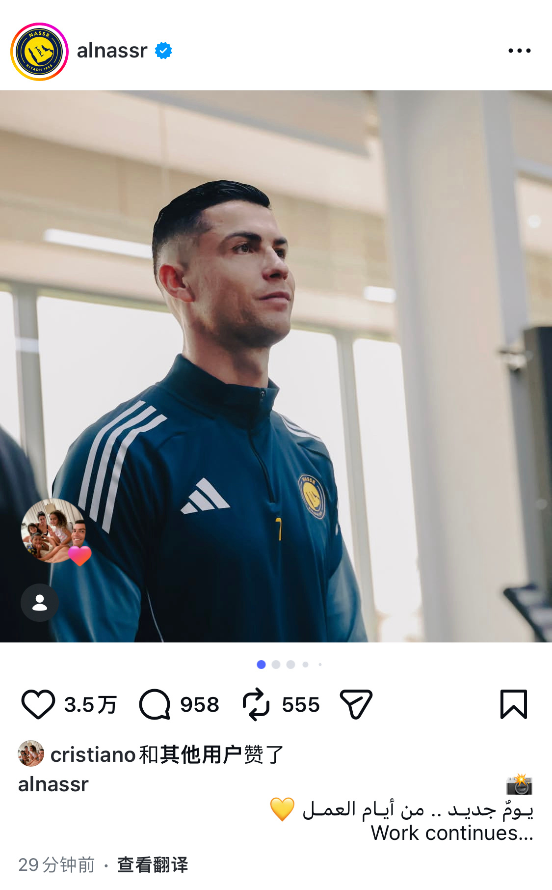 克里斯训练凝视