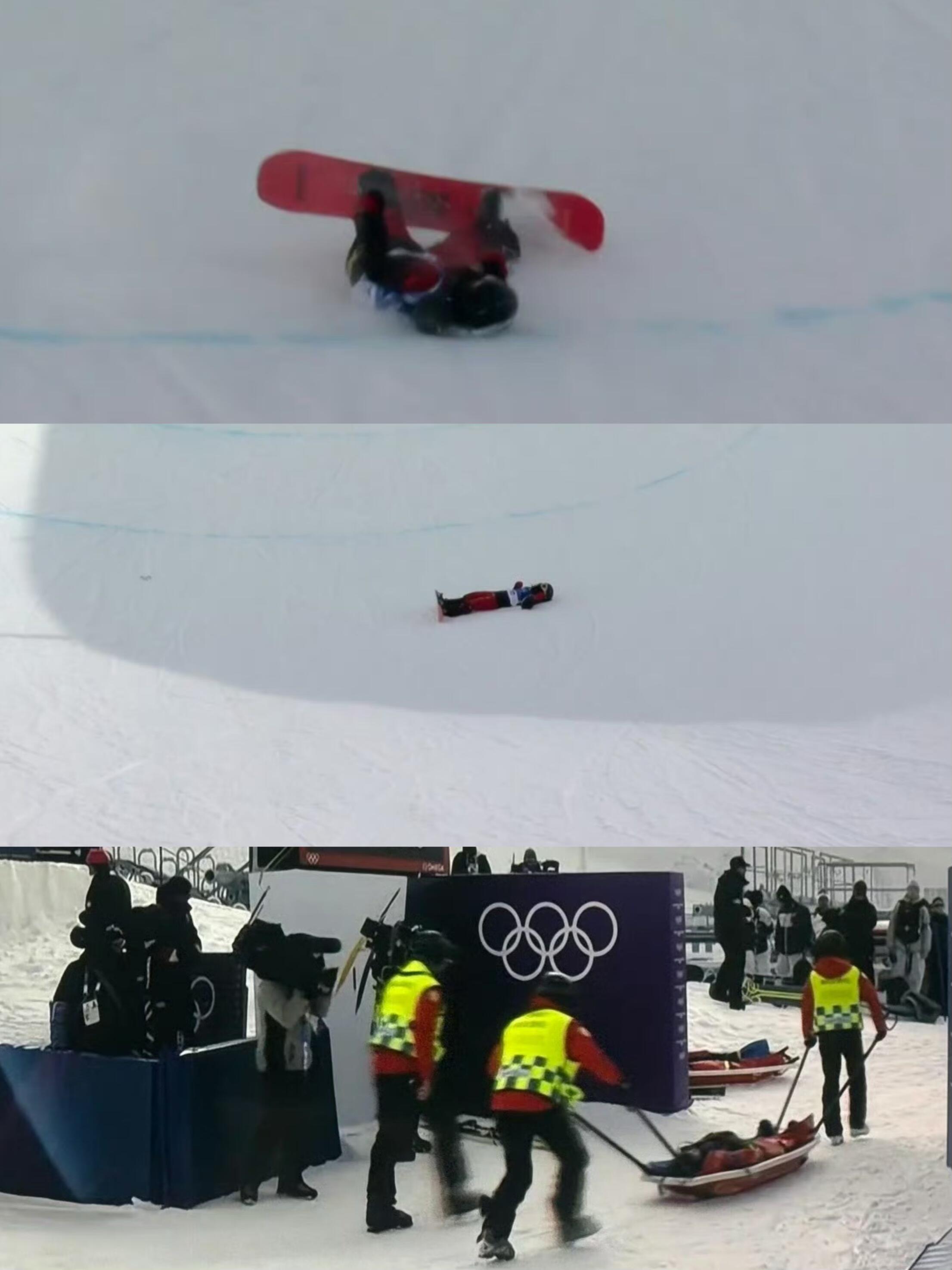 刘佳宇摔倒米兰冬奥现场十分惊险，刘佳宇在最后一个起跳点失去控制，头冲前摔向雪面 