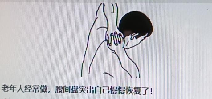 老人腰间盘突出想慢慢恢复，有些动作或许有用，但可别瞎练。像网上流传每天吊单杠 1