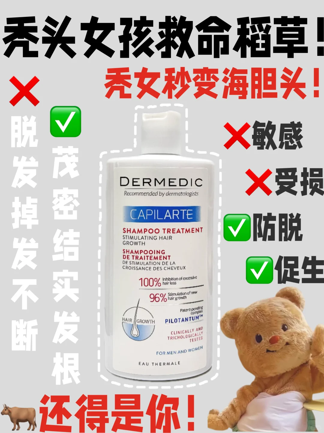 秒变海胆头！防脱生发这块属实拿捏了！