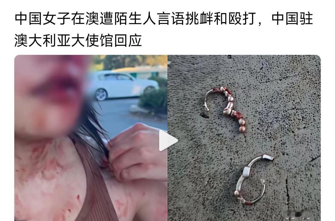我们国家一个女子，在澳大利亚游玩。她被陌生人挑衅，被骂了，还被打了。痛苦得不得了