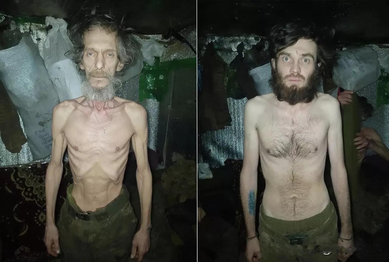 【俄媒曝：乌克兰士兵骨瘦如柴的照片开始在乌军中传开】
莫斯科时间2026年4月2