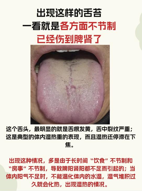 一看这样的舌象，就是各方面不节制而导致的