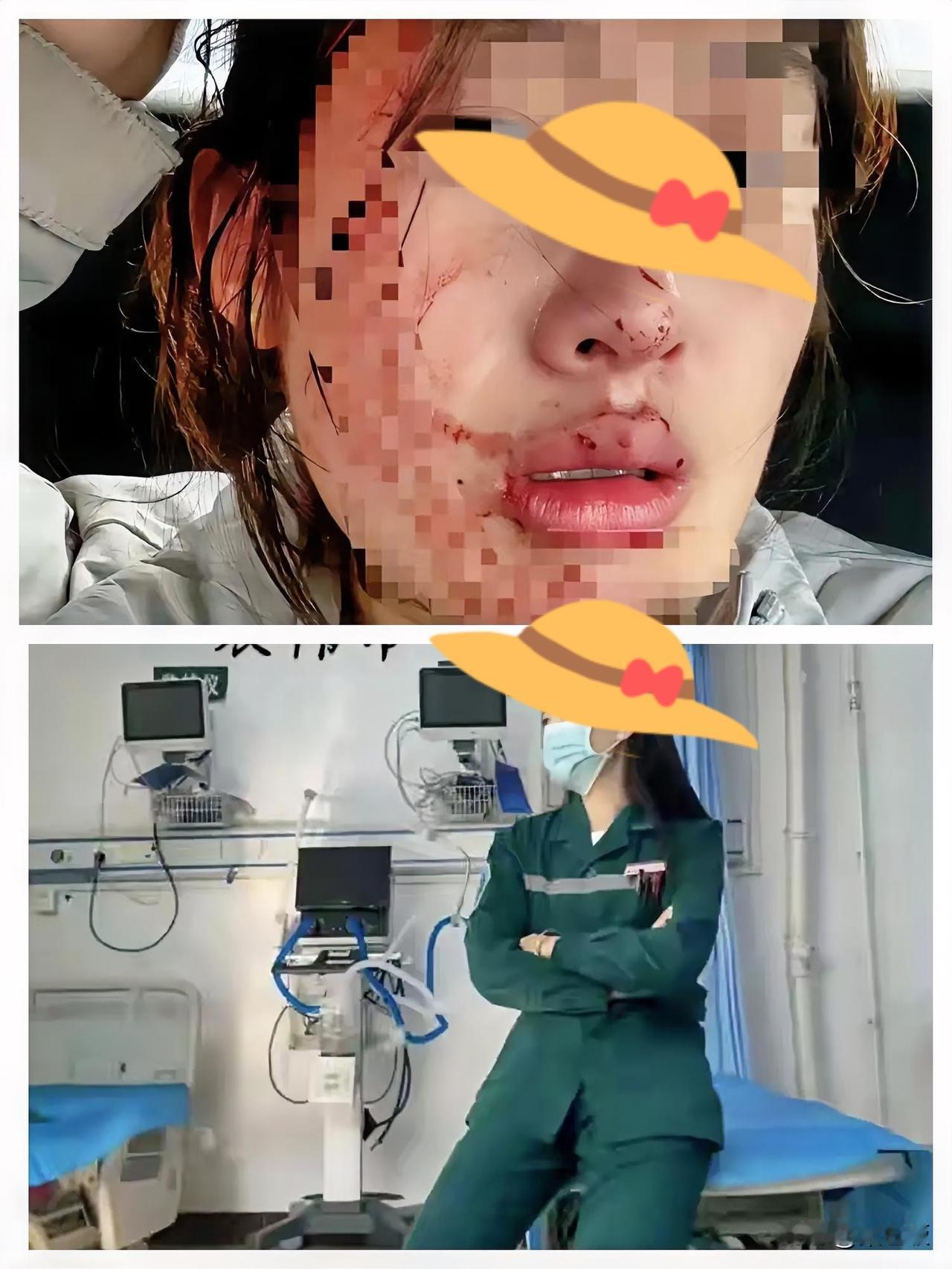 真替秦皇岛女护士鸣不平

小孩子血管本来就细，加上生病不舒服哭闹，血管没扎上也在